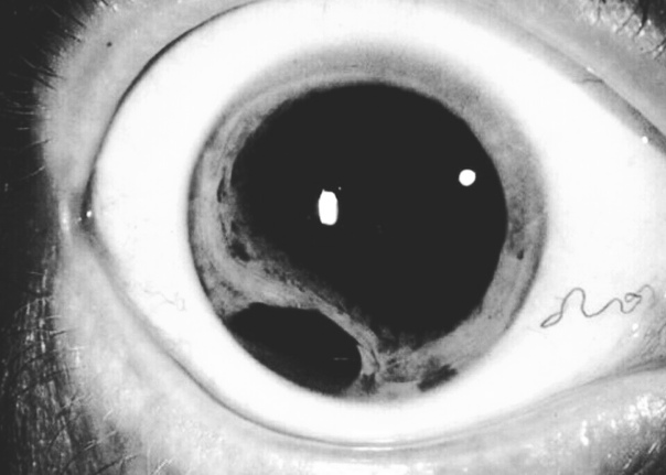 Глаз наиболее самостоятельный из наших органов. Причина в том, что объекты его внимания неизбежно